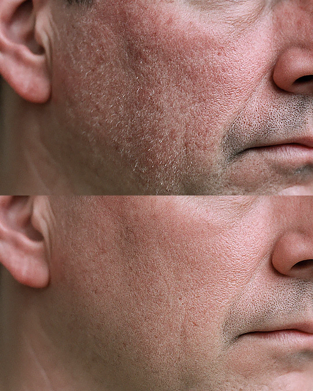 Particle 43 Anti-Aging Shaving Gel