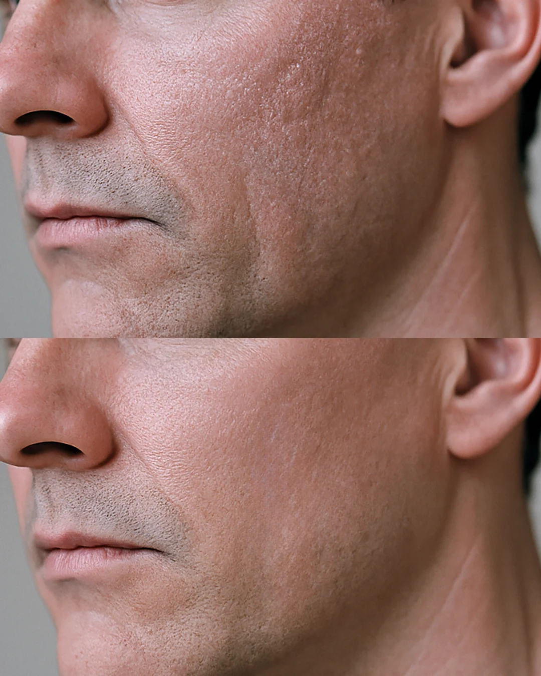Particle 43 Anti-Aging Shaving Gel